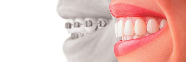 Orthodontie