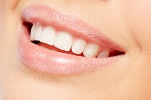 Esthétique du Sourire