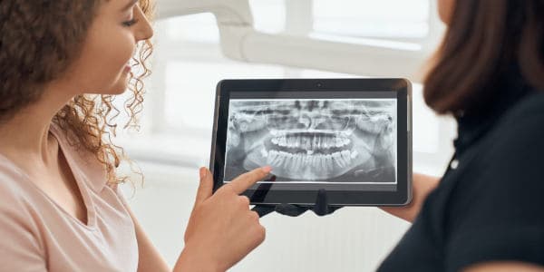 Mise en place de l'implant